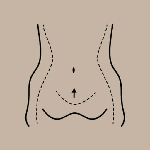Abdominoplasty Image