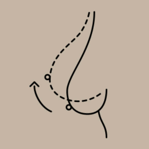 Breast Lift Image